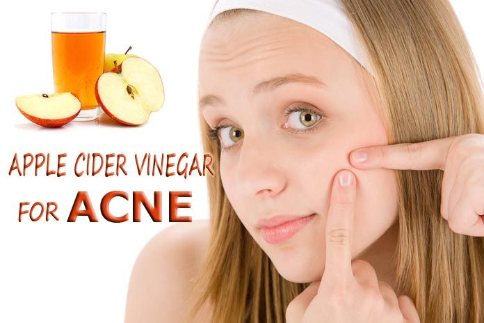 apple-cider-vinegar-for-acne-k7yfyka4